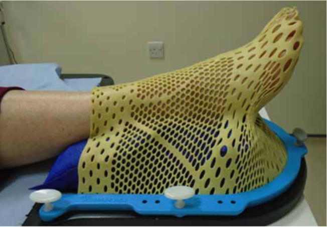 Thermoplastic cast covering the ankle and foot of a patient about to have radiotherapy. The cast has perforations (little holes like a mesh) and is made from a soft yellow plastic