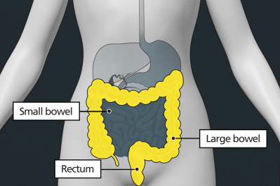 Image showing the bowel looping around the lower half of the abdomen, below the stomach