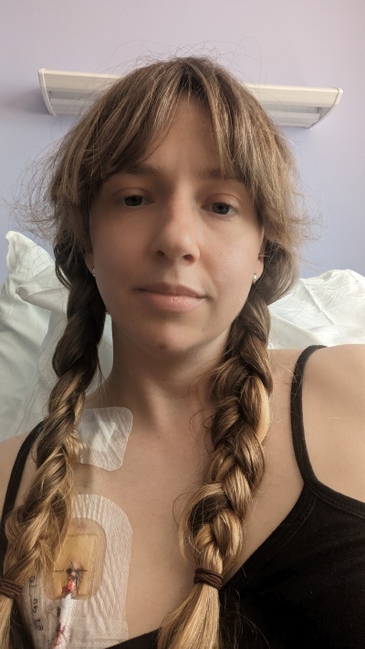 Hannah during treatment.jpg